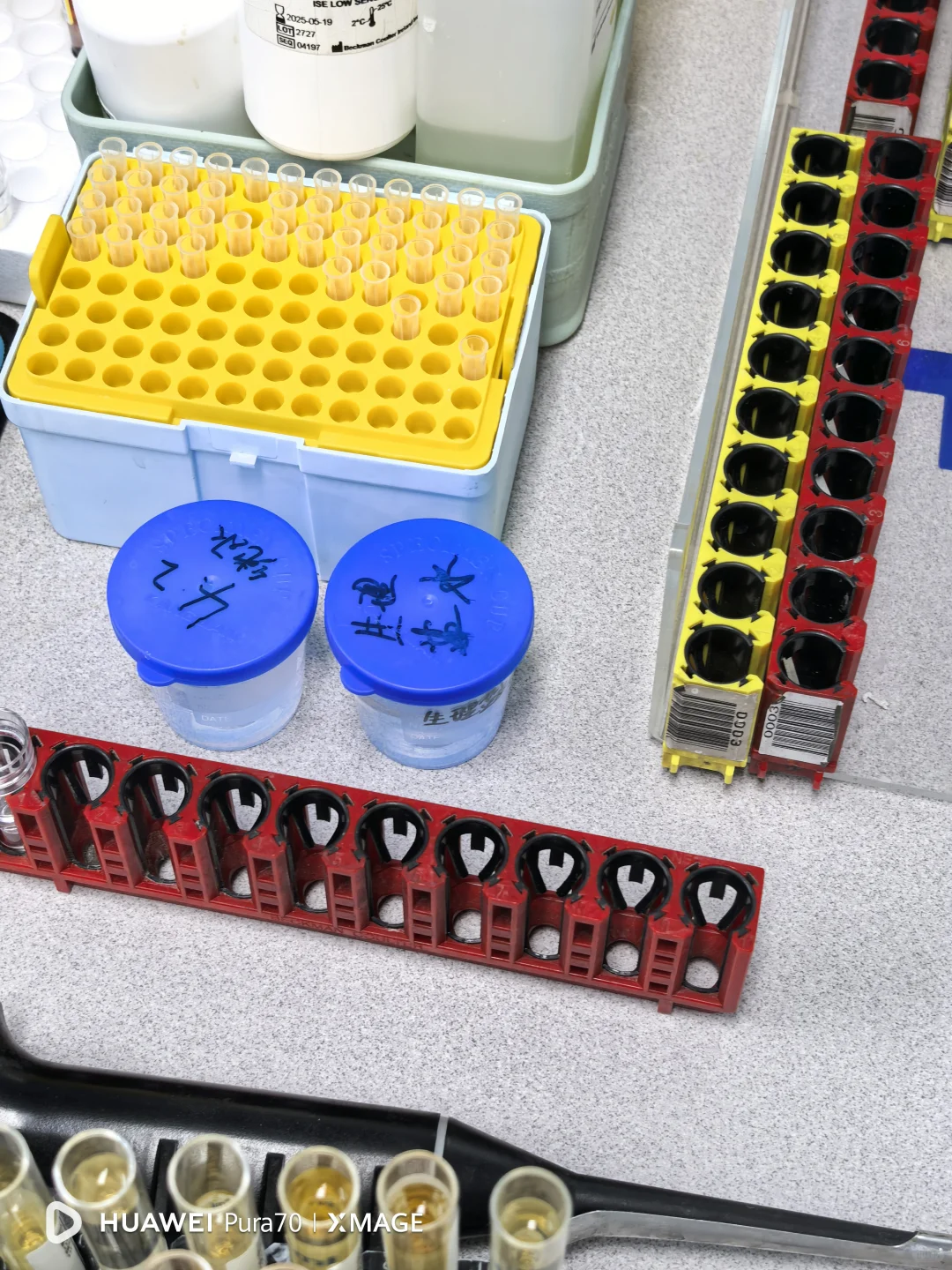 4.17 生化单机+血气分析