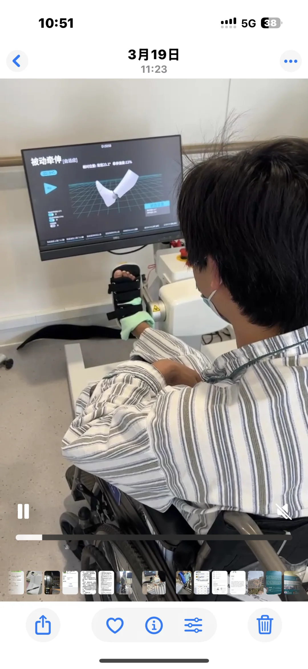 下肢康复治疗区的宝贝先亮相！