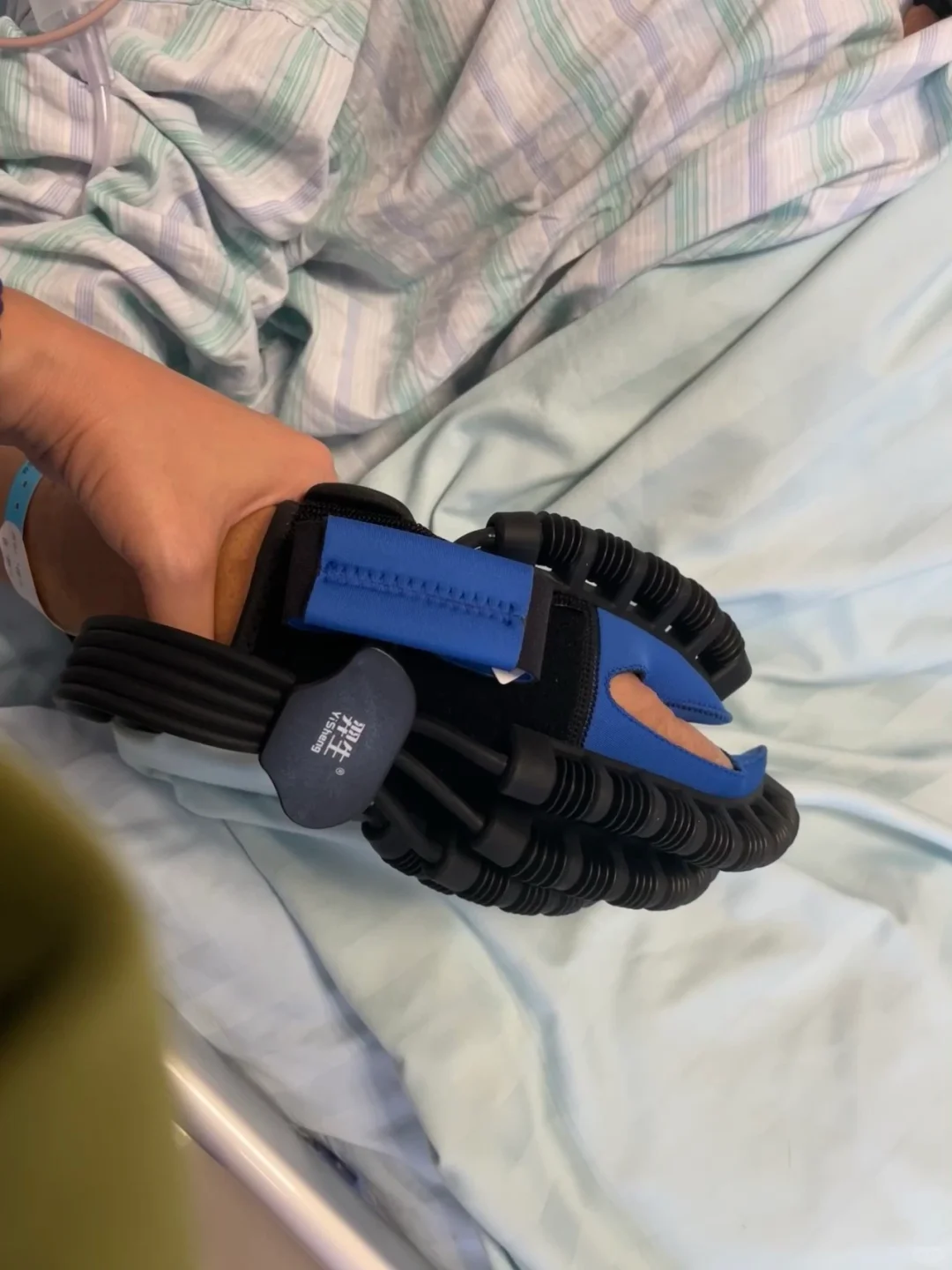 脑梗6｜机器人手助恢复锻炼肌肉