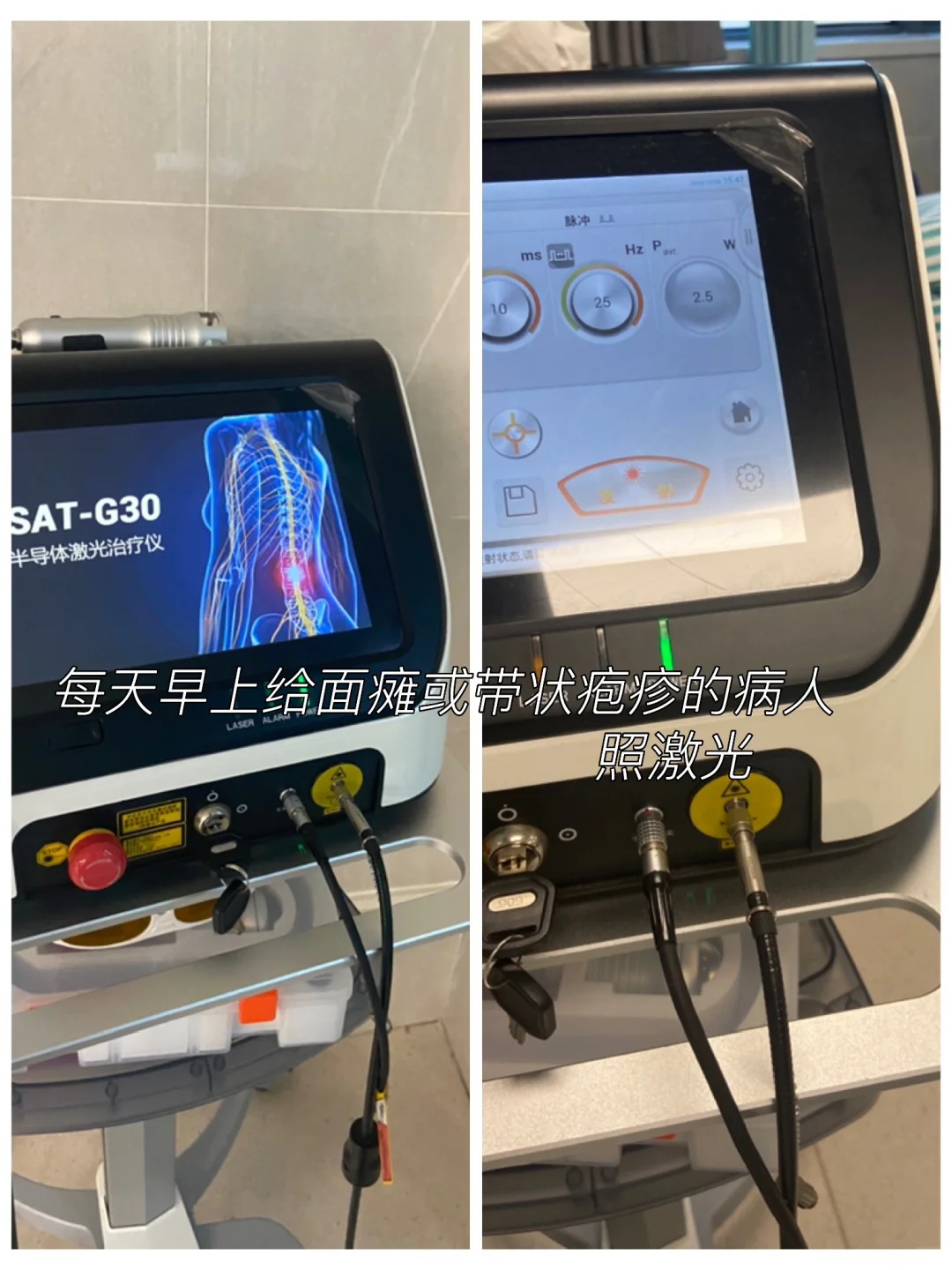 在康复医学科理疗室上班一天都干些什么呢