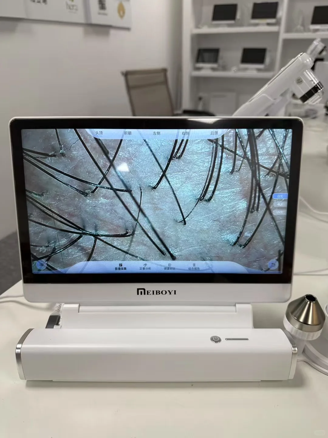 出一台AI智能头皮检测仪