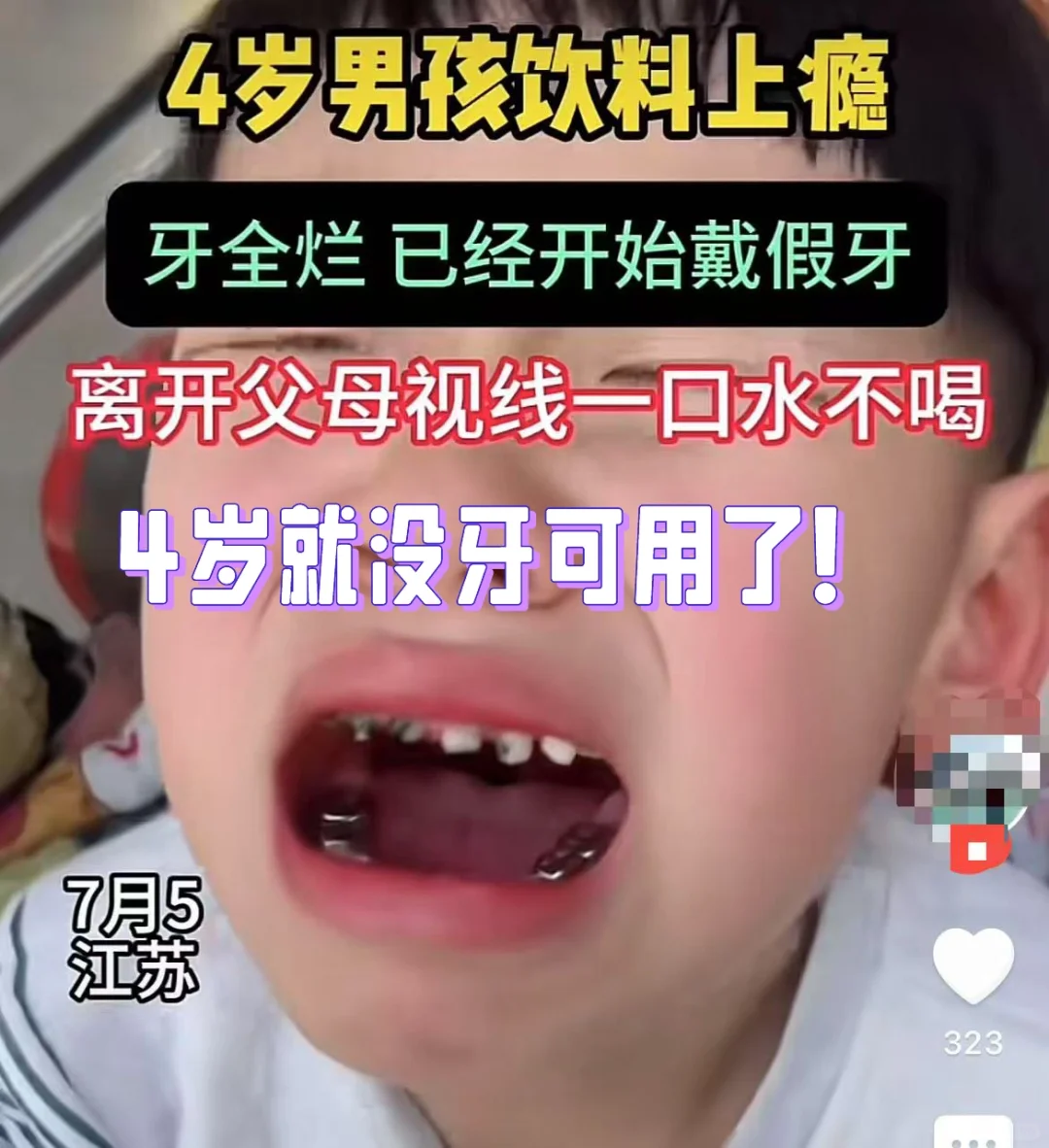 4岁男孩长期喝饮料满嘴烂牙