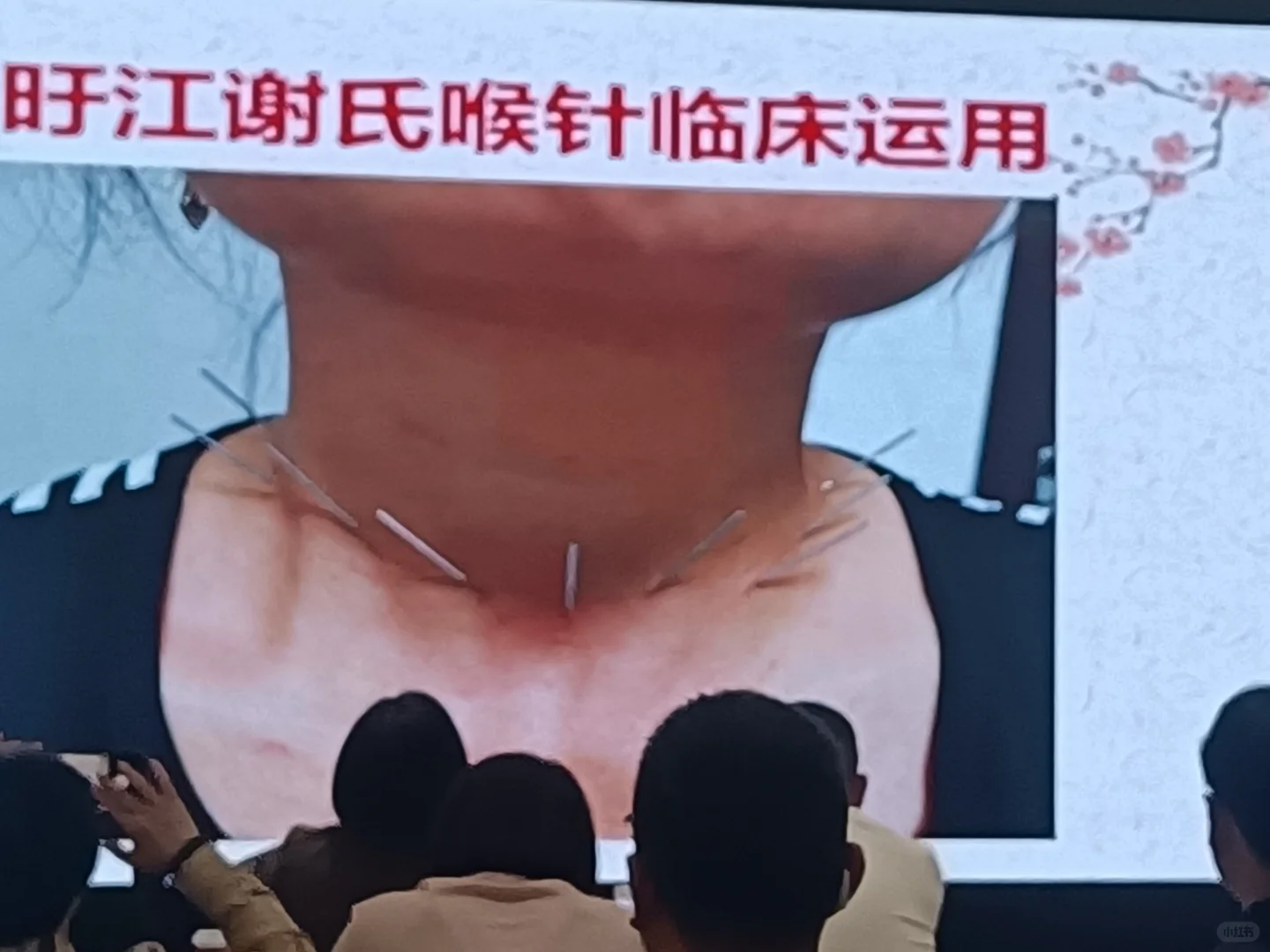 参访2025第六届诊博会记录