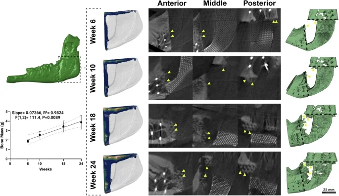 大子刊Nature C.|永久人造骨:骨再生新突破