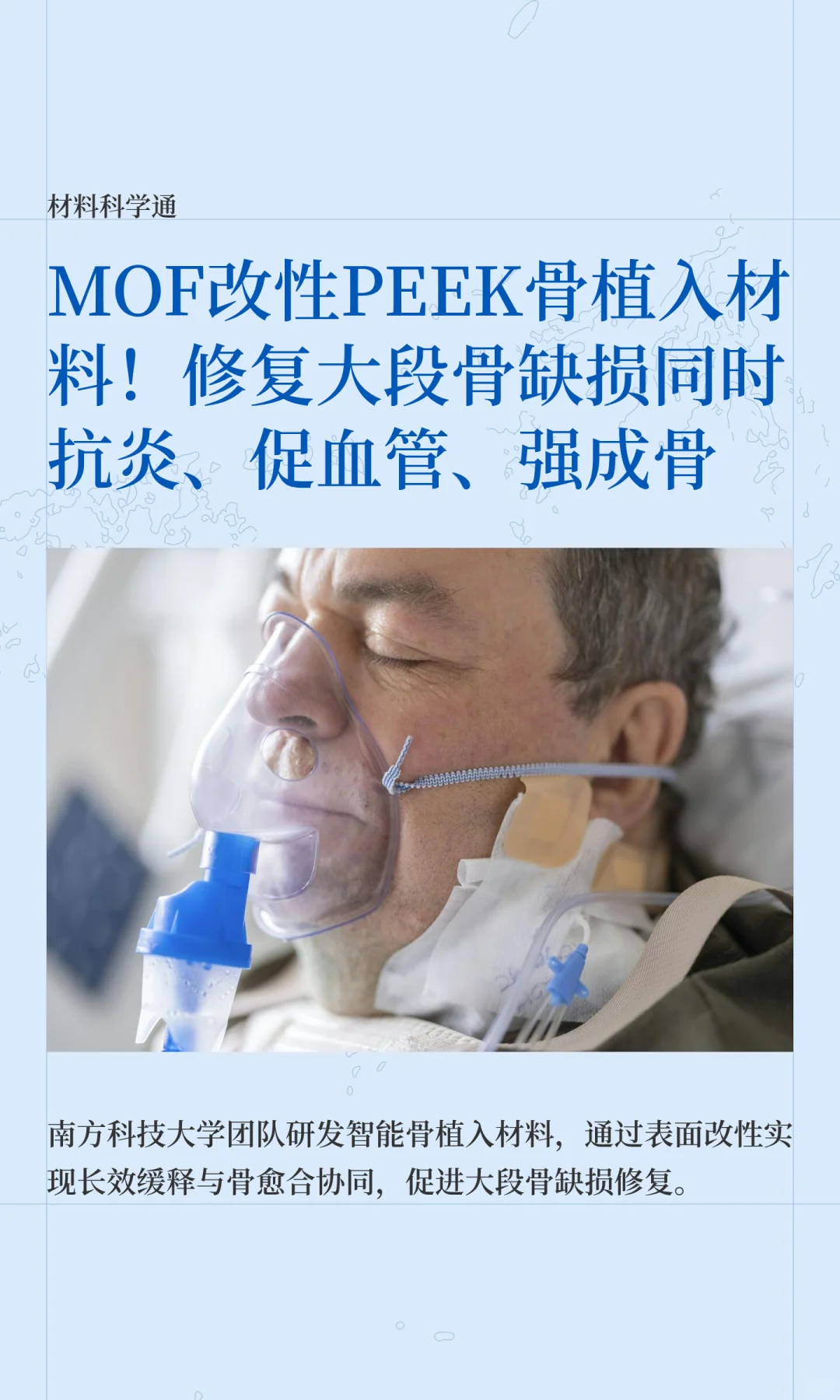 MOF改性PEEK骨植入材料！修复大段骨缺损同