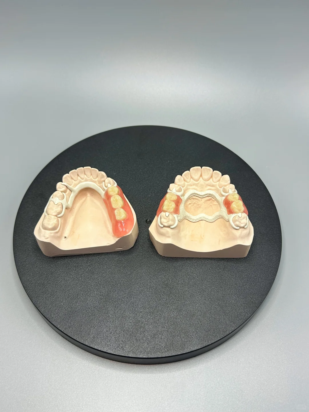 爸爸缺了6颗牙 做了这个