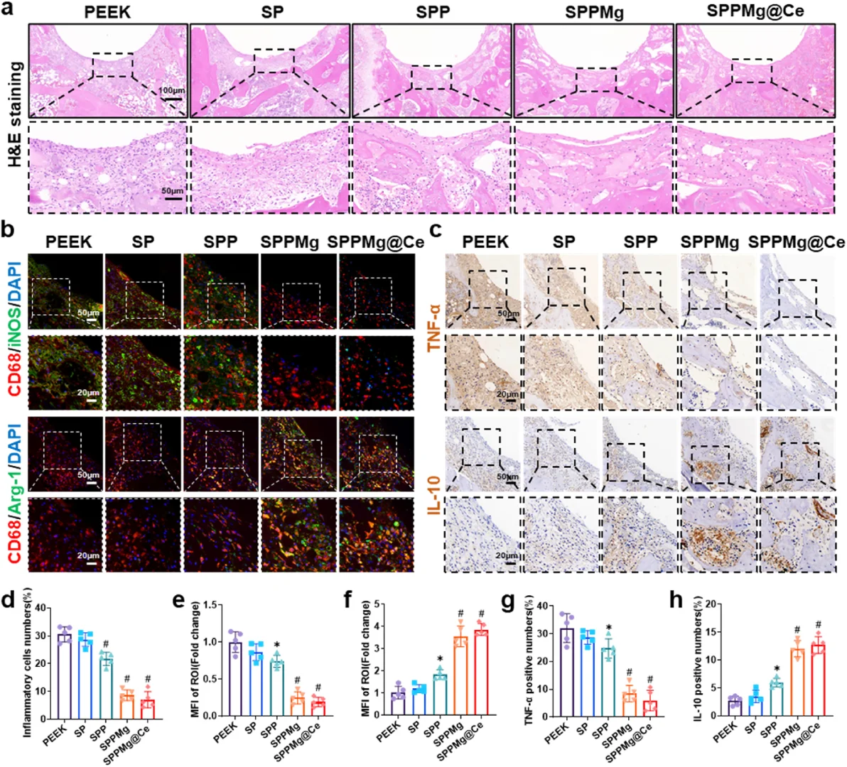 抗菌&骨免疫调节:微环境响应性聚醚醚酮
