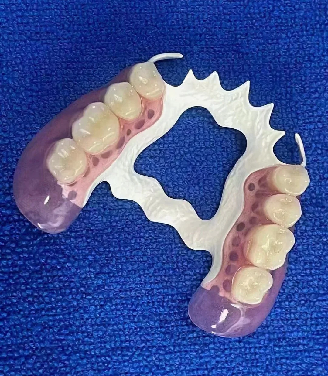 假牙也有“高定版”?更轻、更稳、更高级!