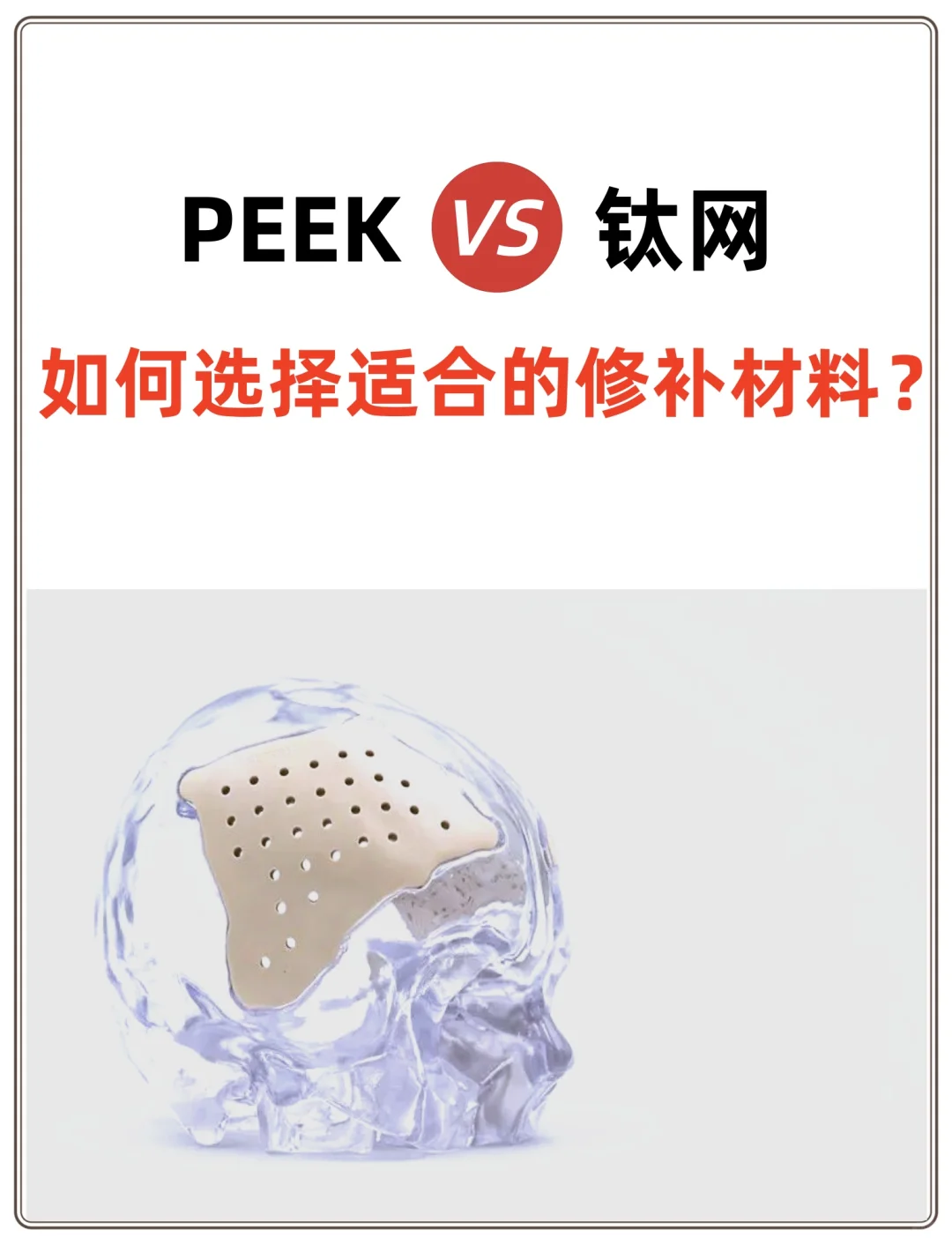 PEEK VS 钛网:如何选择适合的修补材料?
