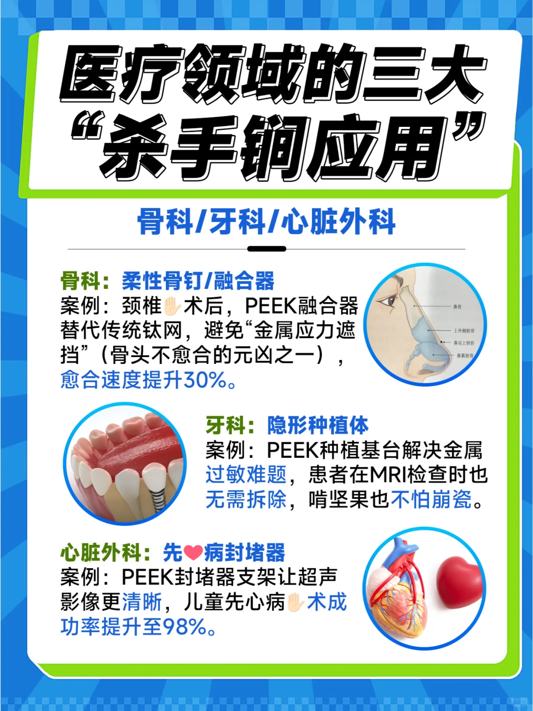 超卢正式入驻小红书❗一篇带你认识PEEK