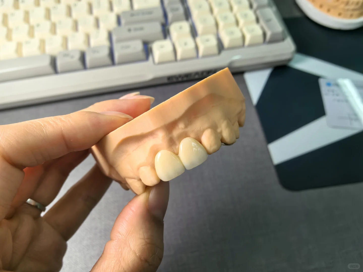 ?假牙带翅膀，多不多余？