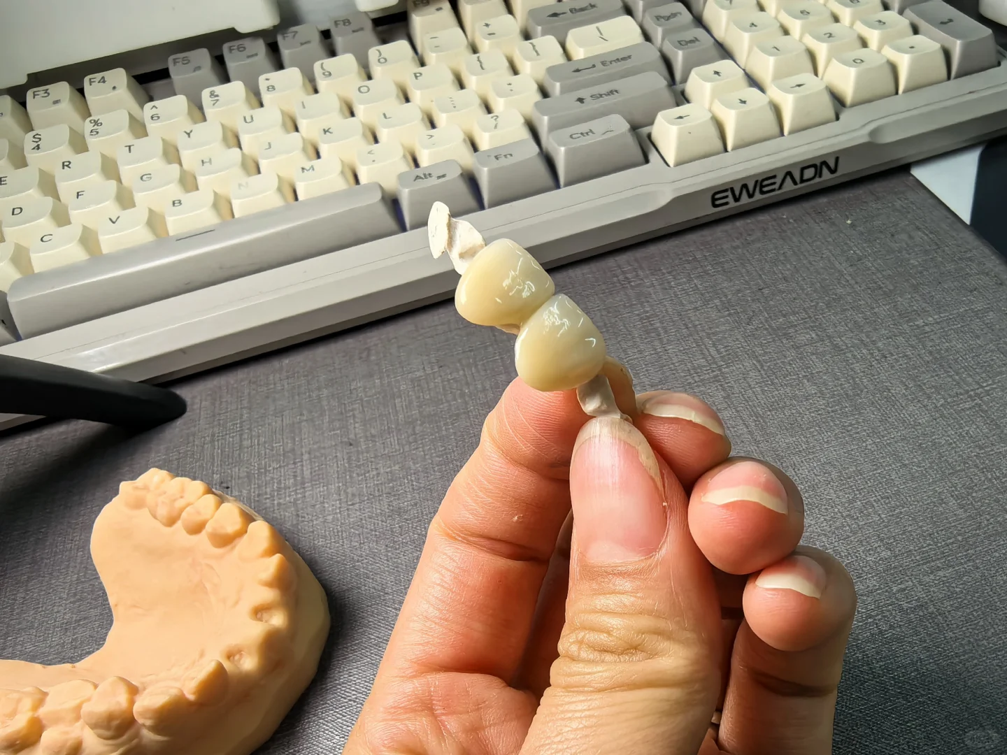 ?假牙带翅膀，多不多余？