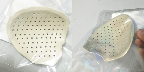 脑出血康复的关键:PEEK颅骨修补的核心优势