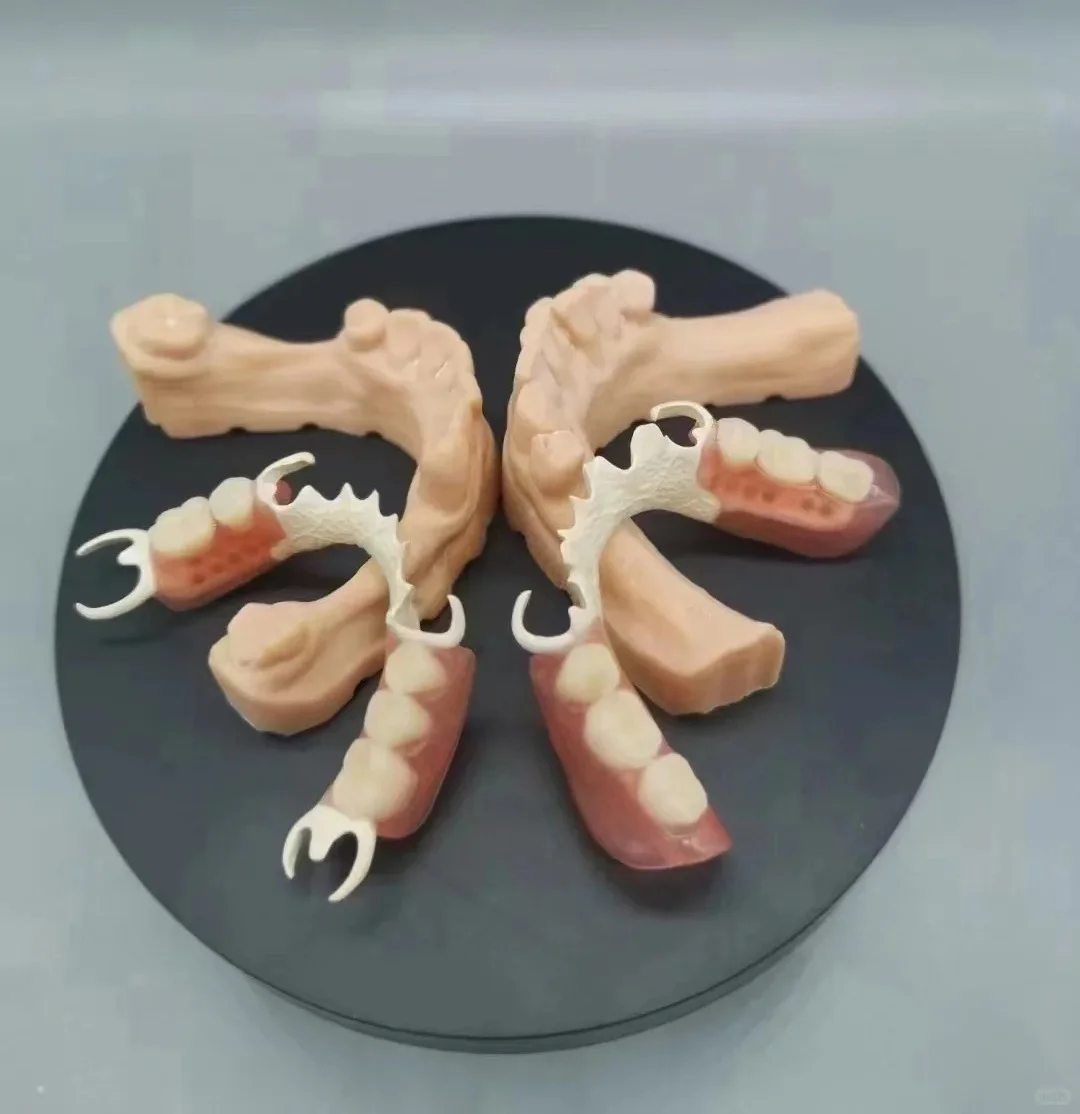 假牙也有“高定版”?更轻、更稳、更高级!