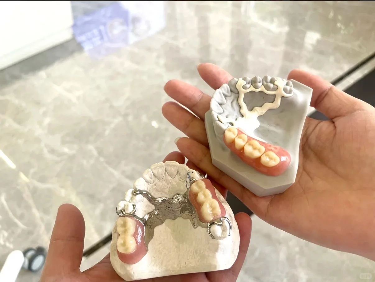 3、?假牙也有“高定版”?更轻、更稳、更高级!