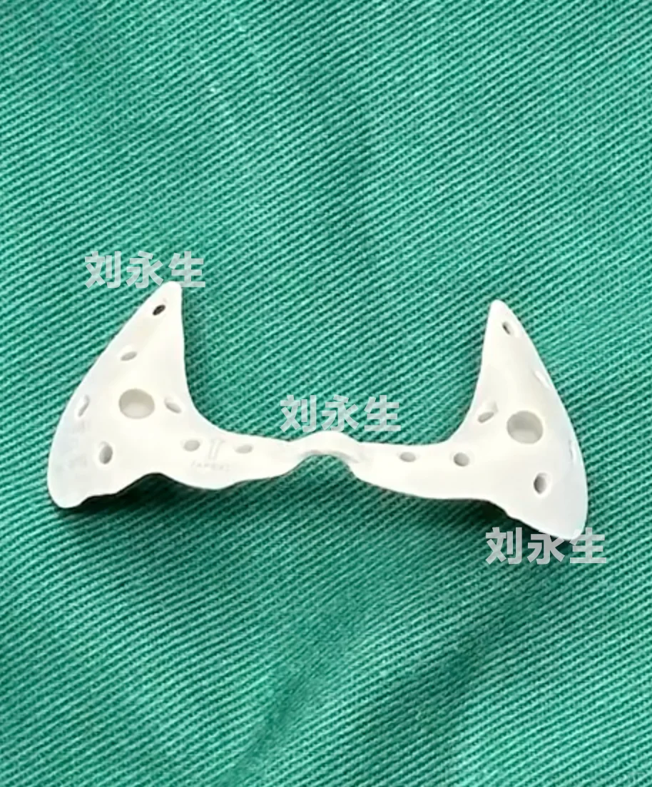 3D如何打印鼻基底，面诊前一定要做的功课