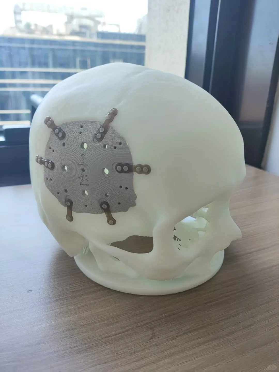 PEEK为何是天花板级材料?