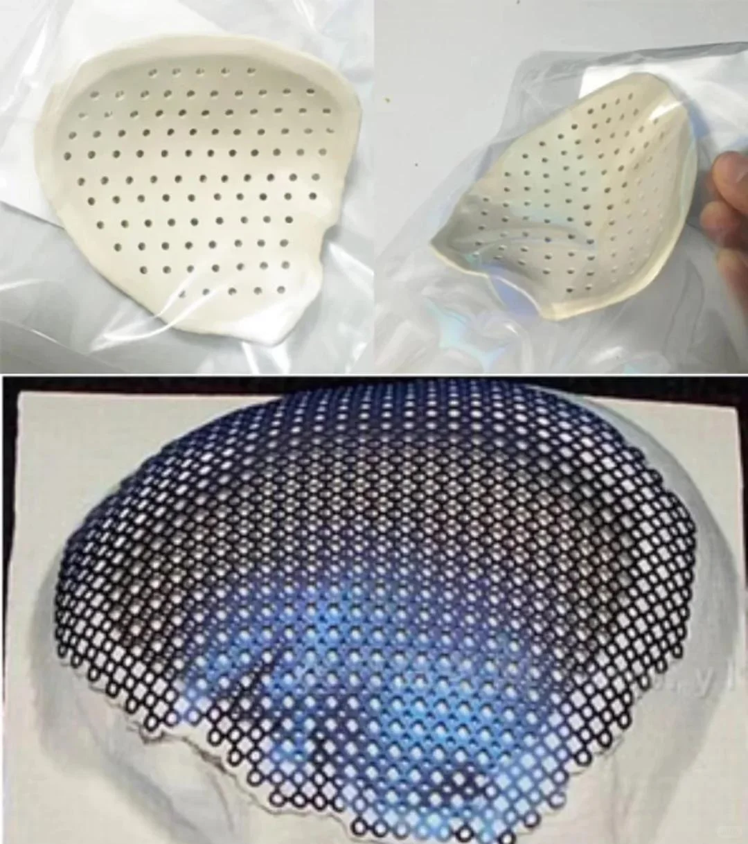 PEEK和钛合金哪个适合颅骨修复?