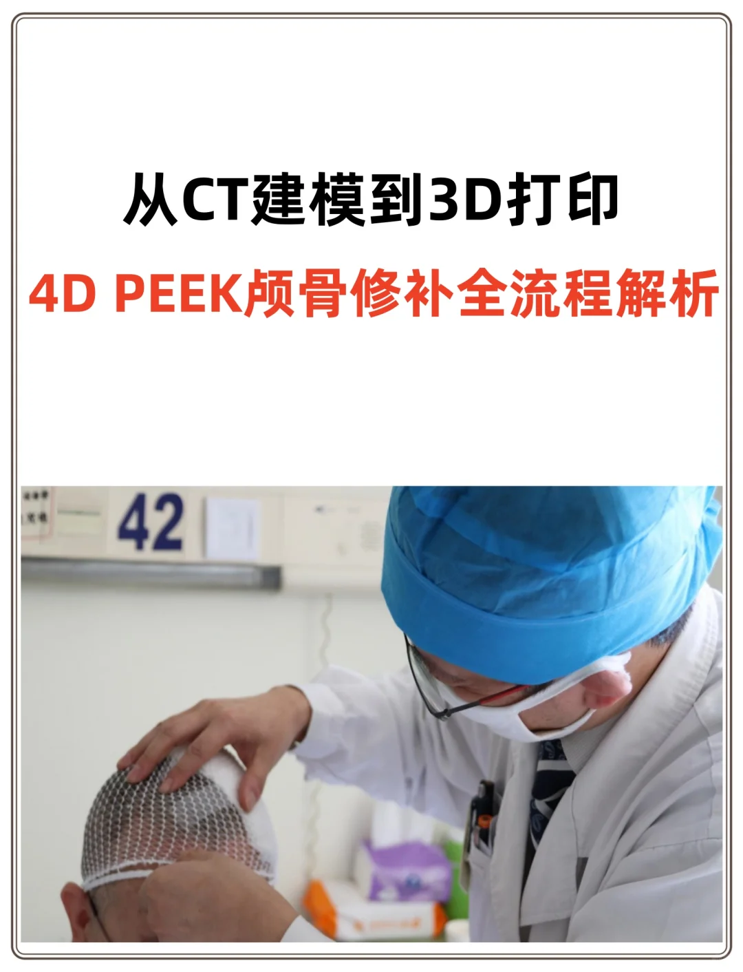 从CT建模到3D打印:4DPEEK颅骨修补流程解析