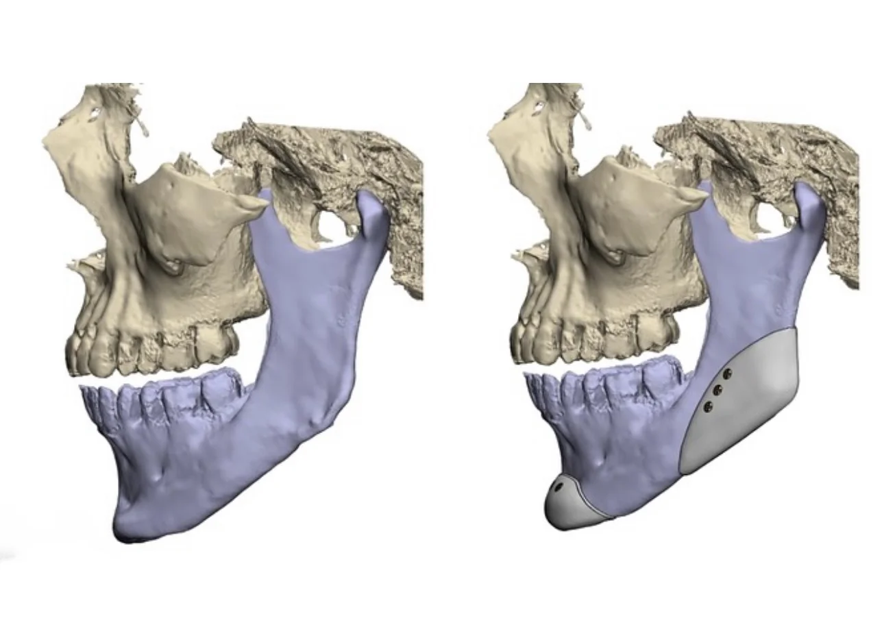 Peek 材料的硬度