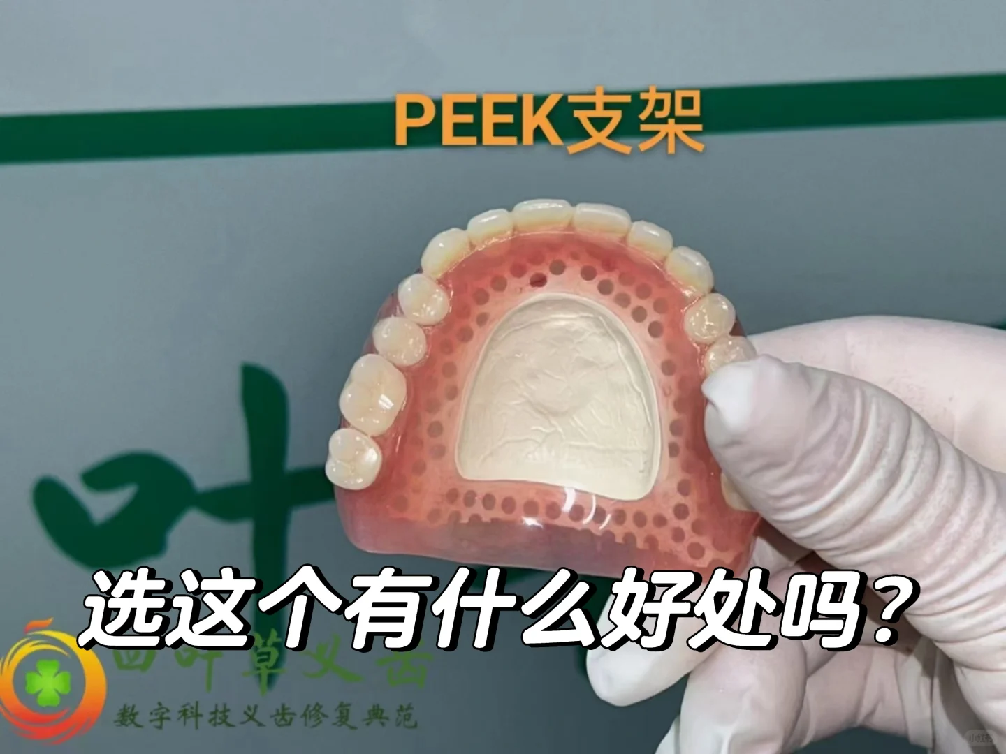 peek 活动类行嘛？