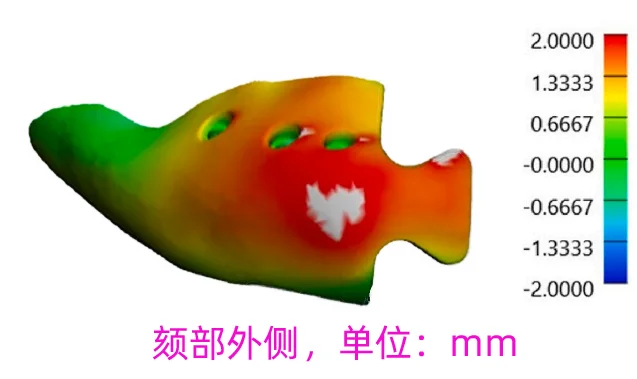 PEEK下巴（颏部）假体成形定位到底多准确？