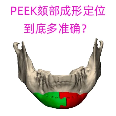 PEEK下巴（颏部）假体成形定位到底多准确？