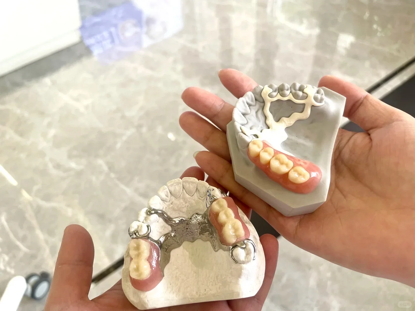 假牙也有“高定版”?更轻、更稳、更高级!