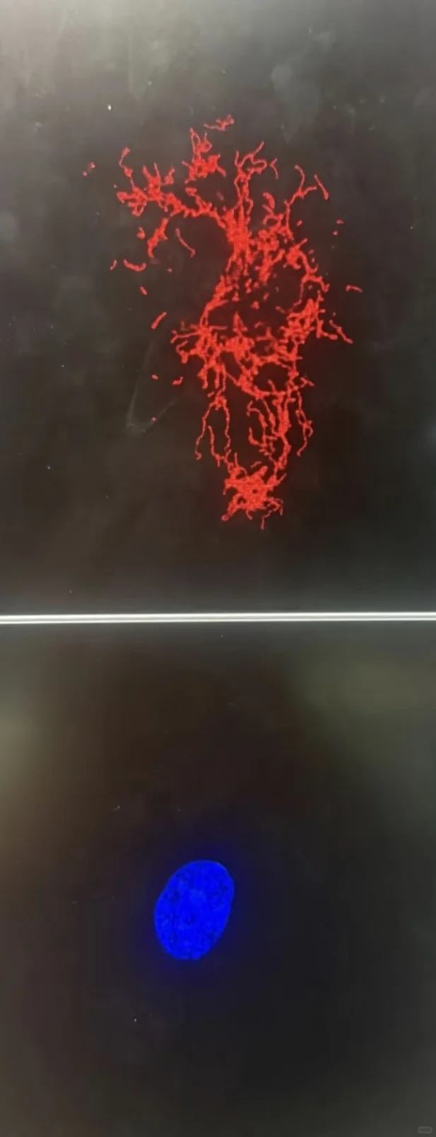 线粒体外膜蛋白TOM20免疫染色固定注意事项