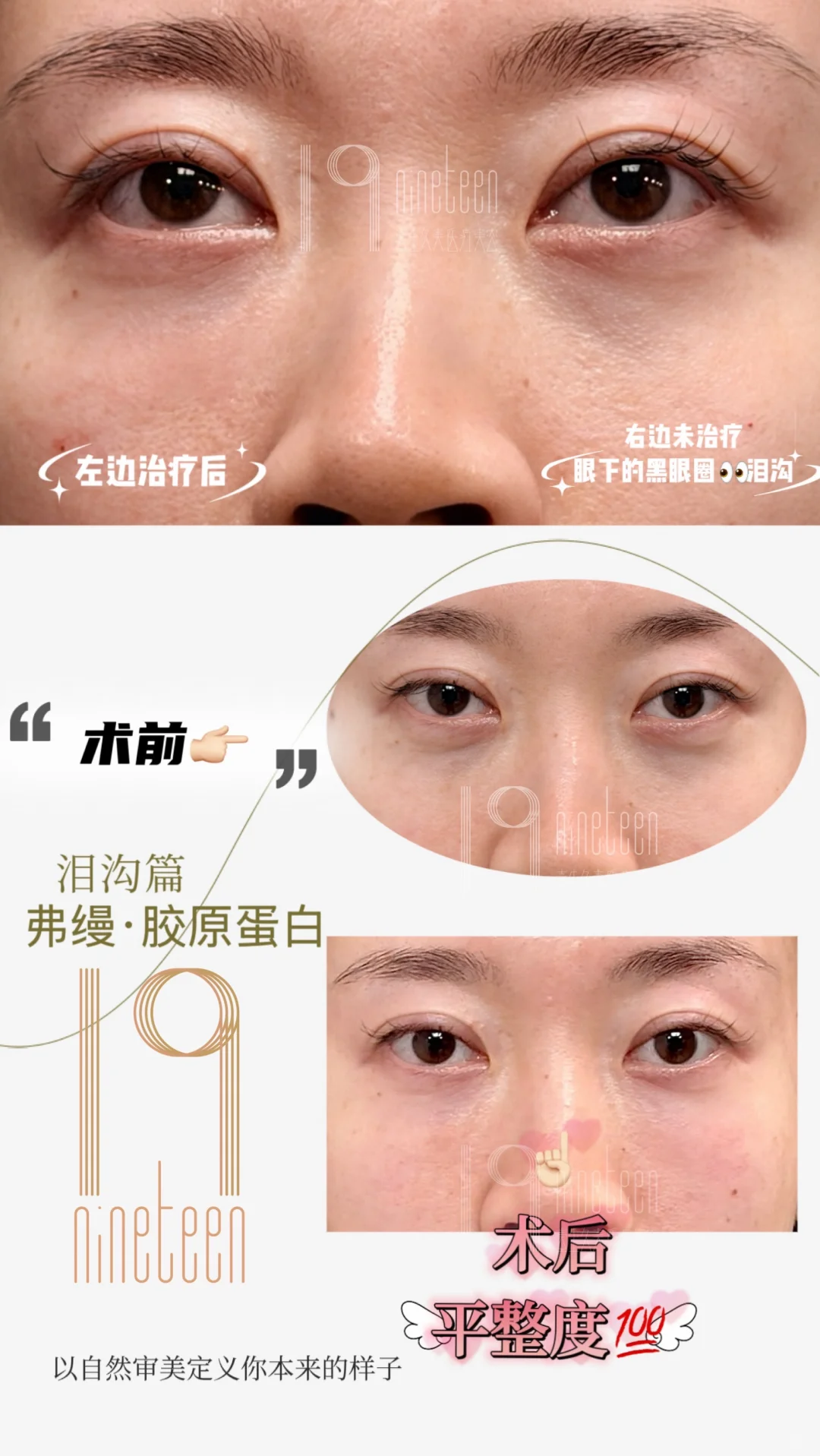 自然审美观 小小案例分享一下