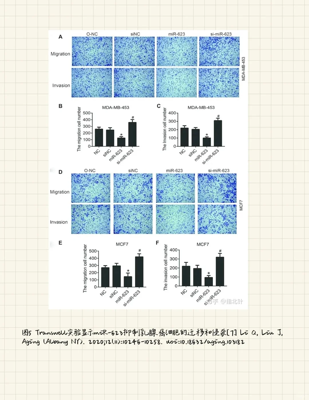 Transwell实验一次性通关！保姆级教程?