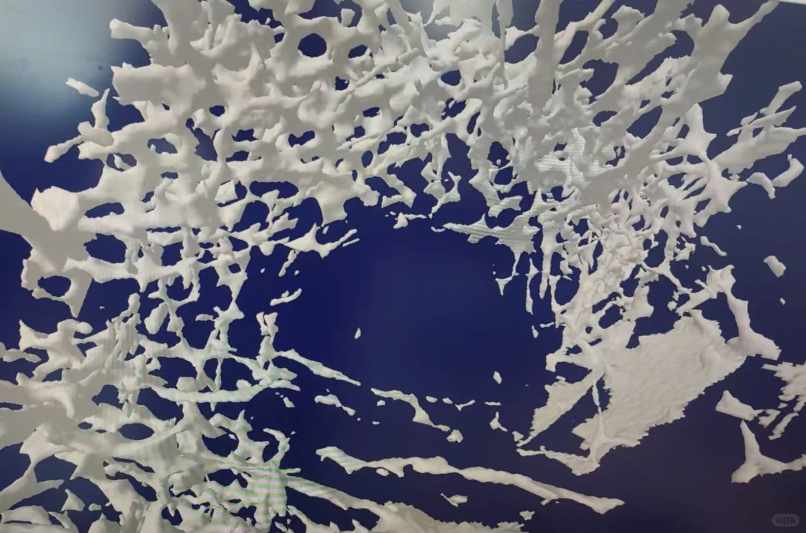 Micro-CT骨小梁三维结构定量分析技术解析