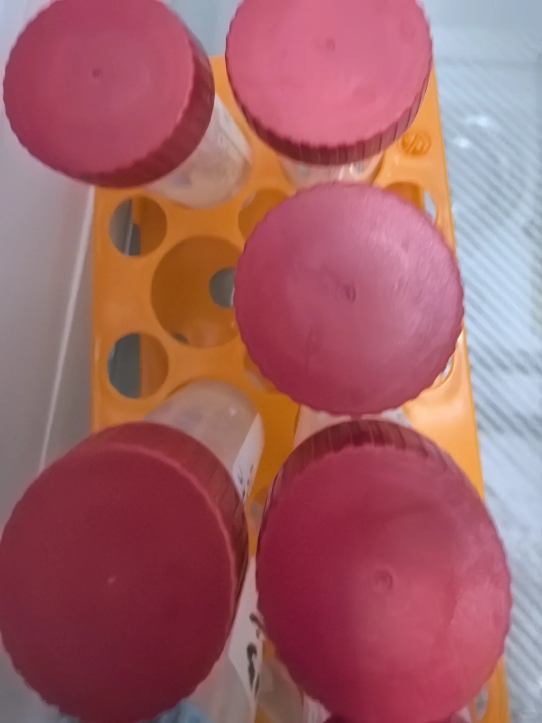 要做免疫荧光的脑袋忘了用多聚甲醛固定咋办