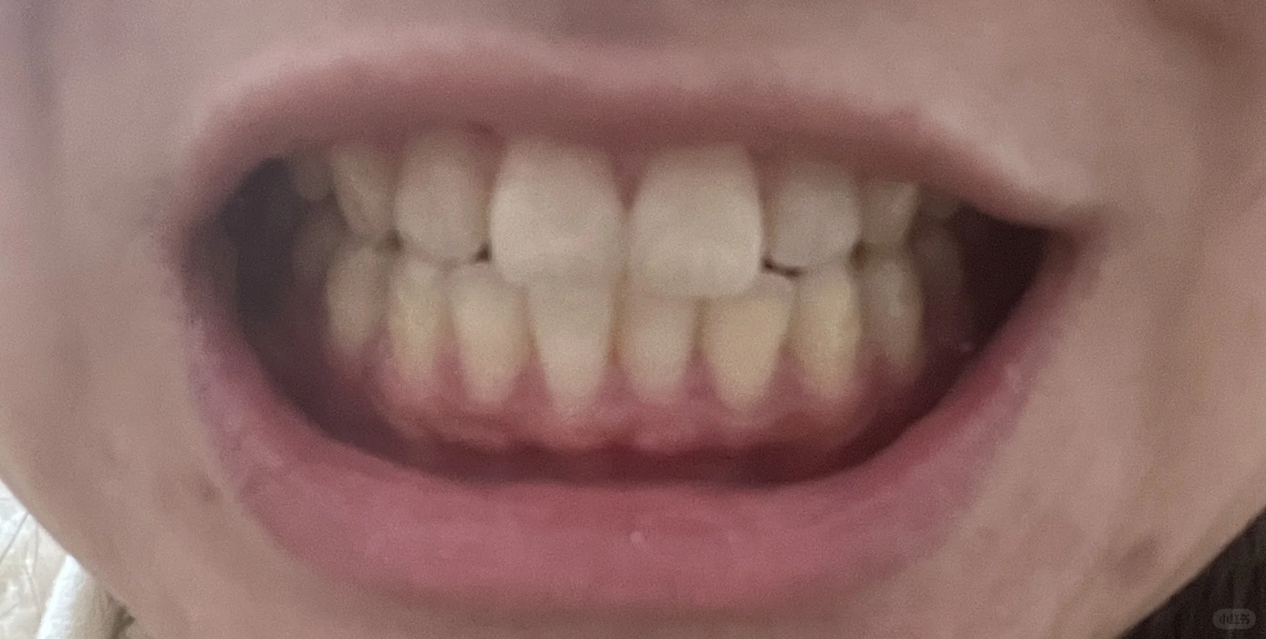 BOP牙膏测评day10