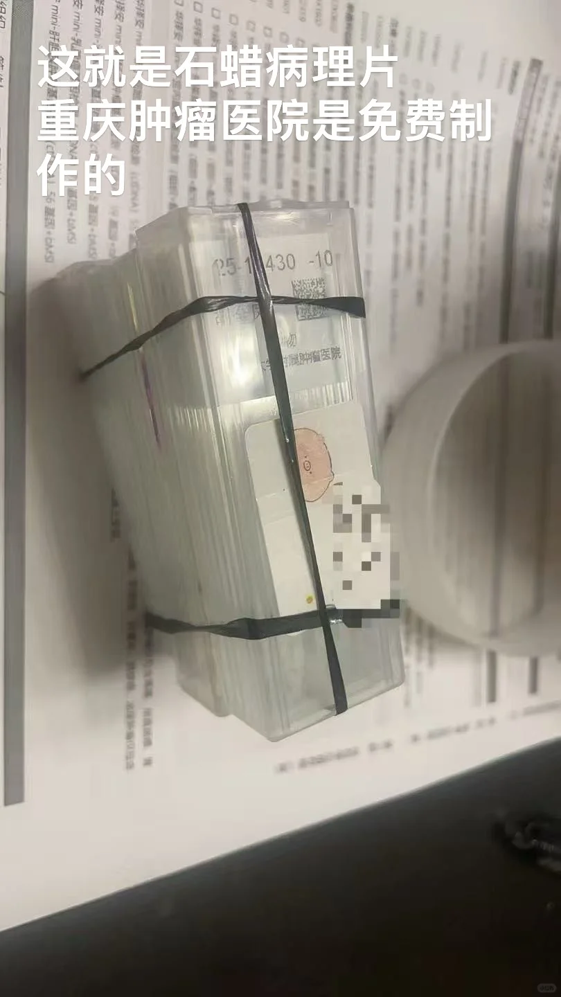 乳腺癌大战攻略之21基因检测(可能豁免化