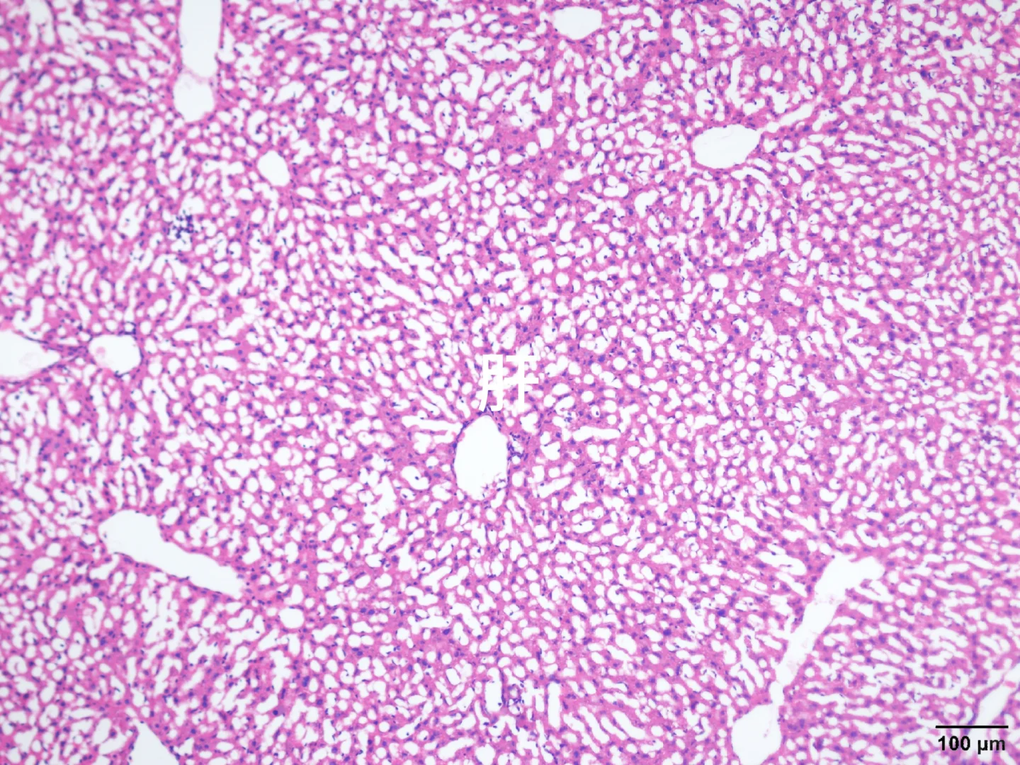 心肝脾肺肾肿瘤HE染色