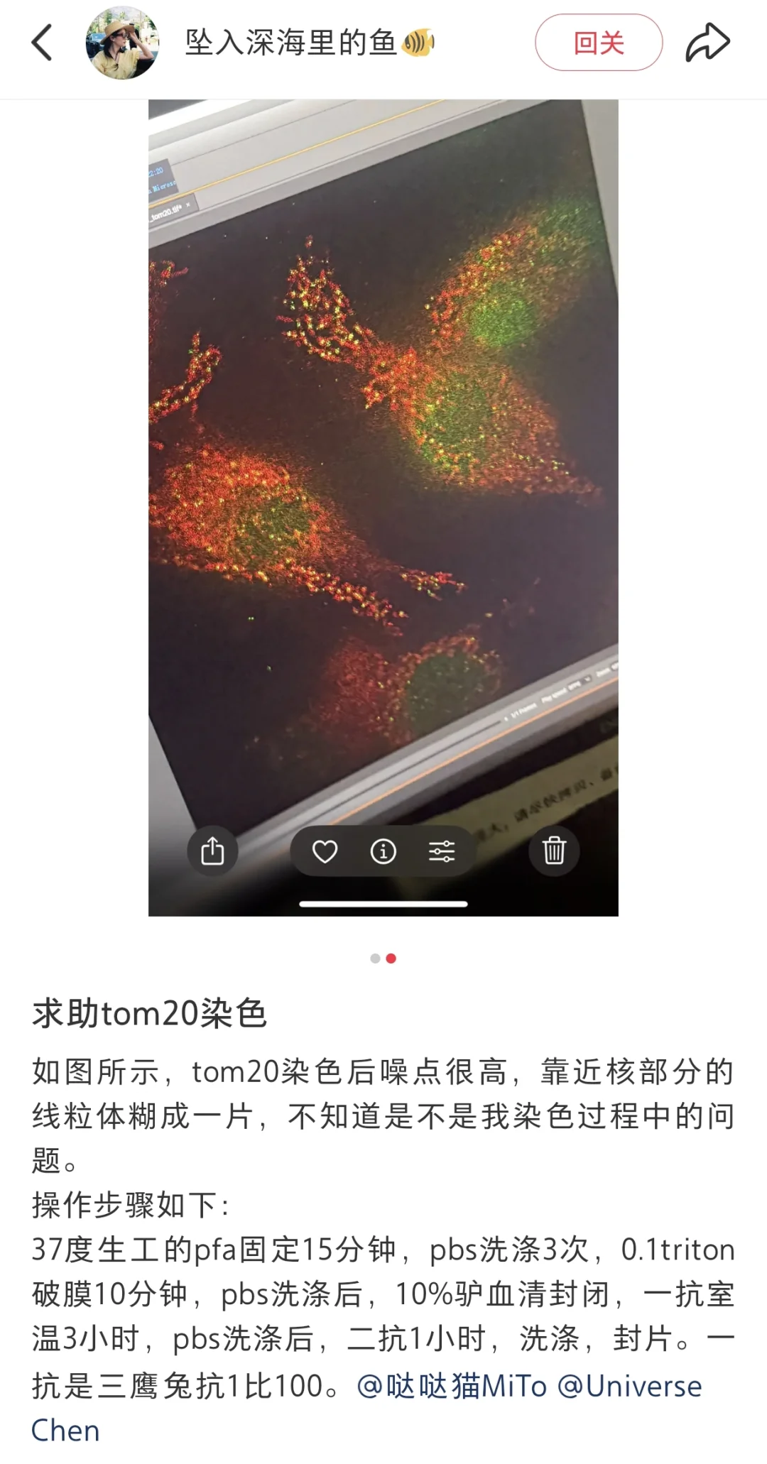 线粒体外膜蛋白TOM20免疫染色固定注意事项