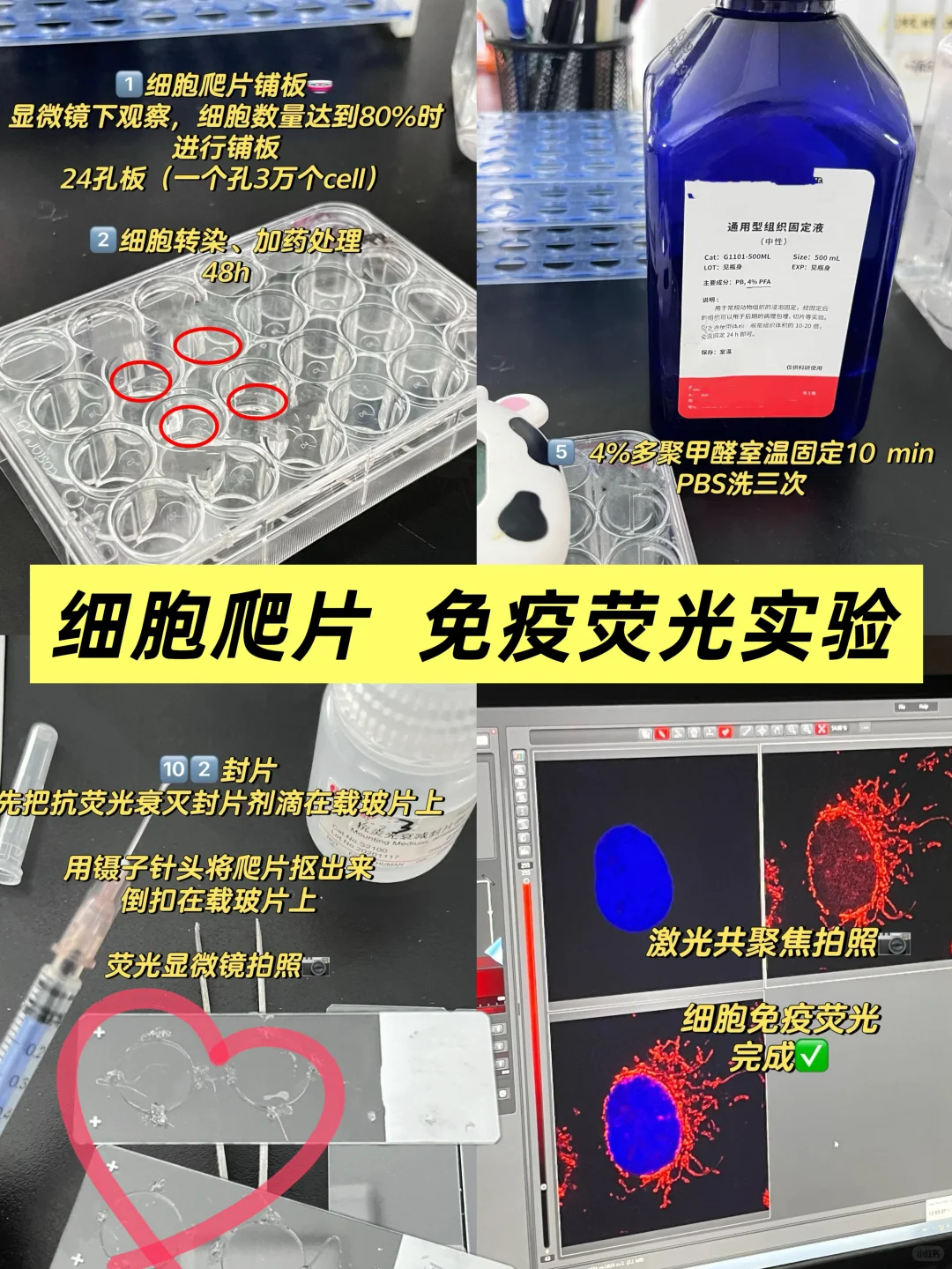 细胞免疫荧光实验 protocol详解‼️