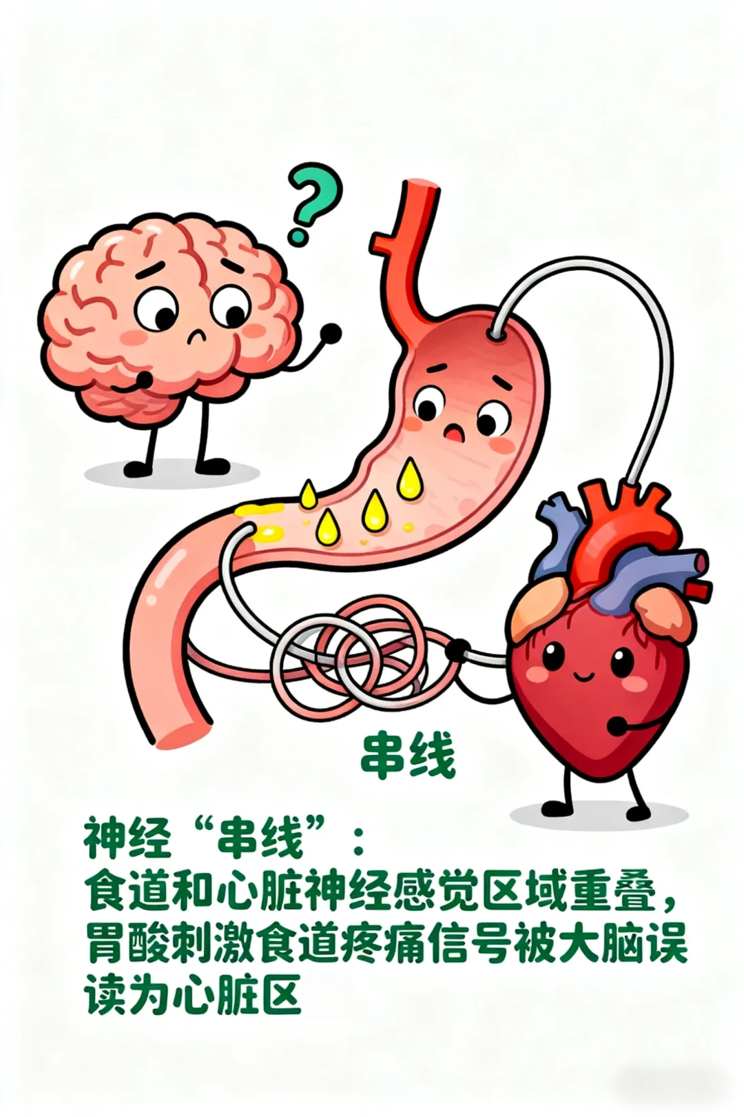 “心脏病”和胃食道反流症状有点像
