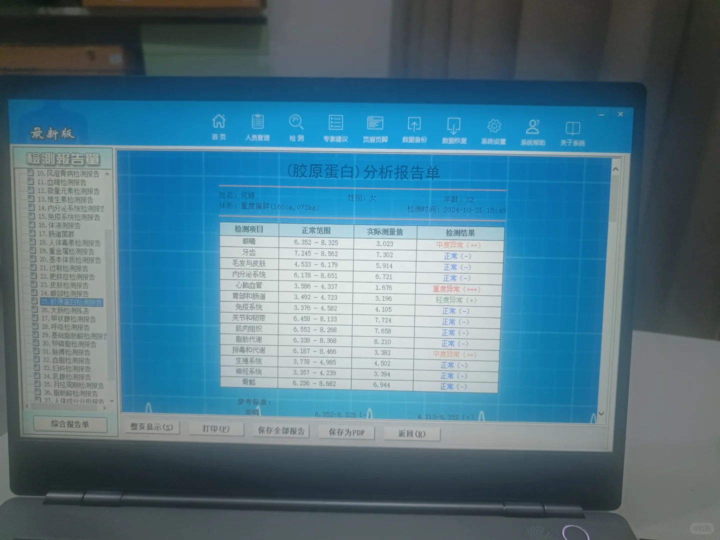 手握式智能体检仪