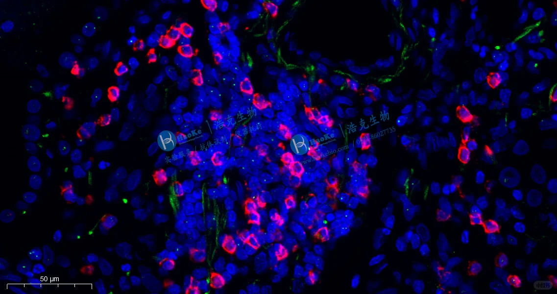✨超详细原位杂交实验攻略?