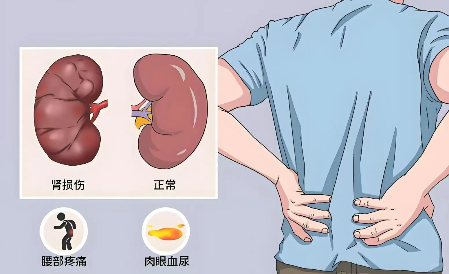 泌尿系统遗传性肿瘤基因检测