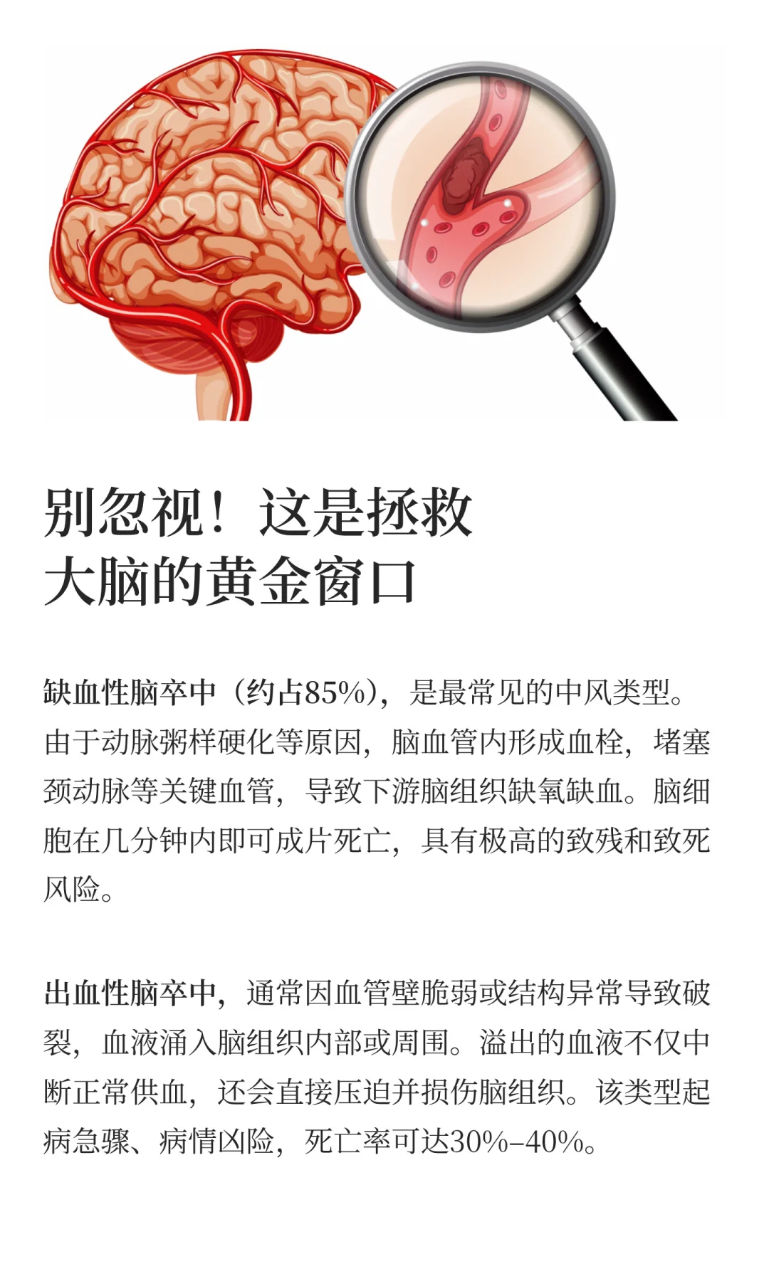 防患于未然，筛查中风常规体检远远不够！