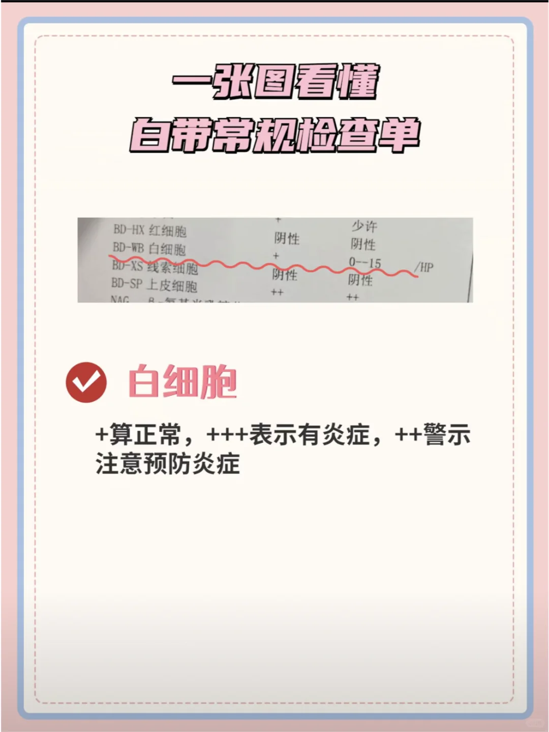 妇科医生教你一张图看懂白带常规检查单