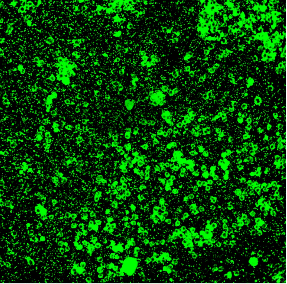 悬浮细胞免疫荧光求助！！！