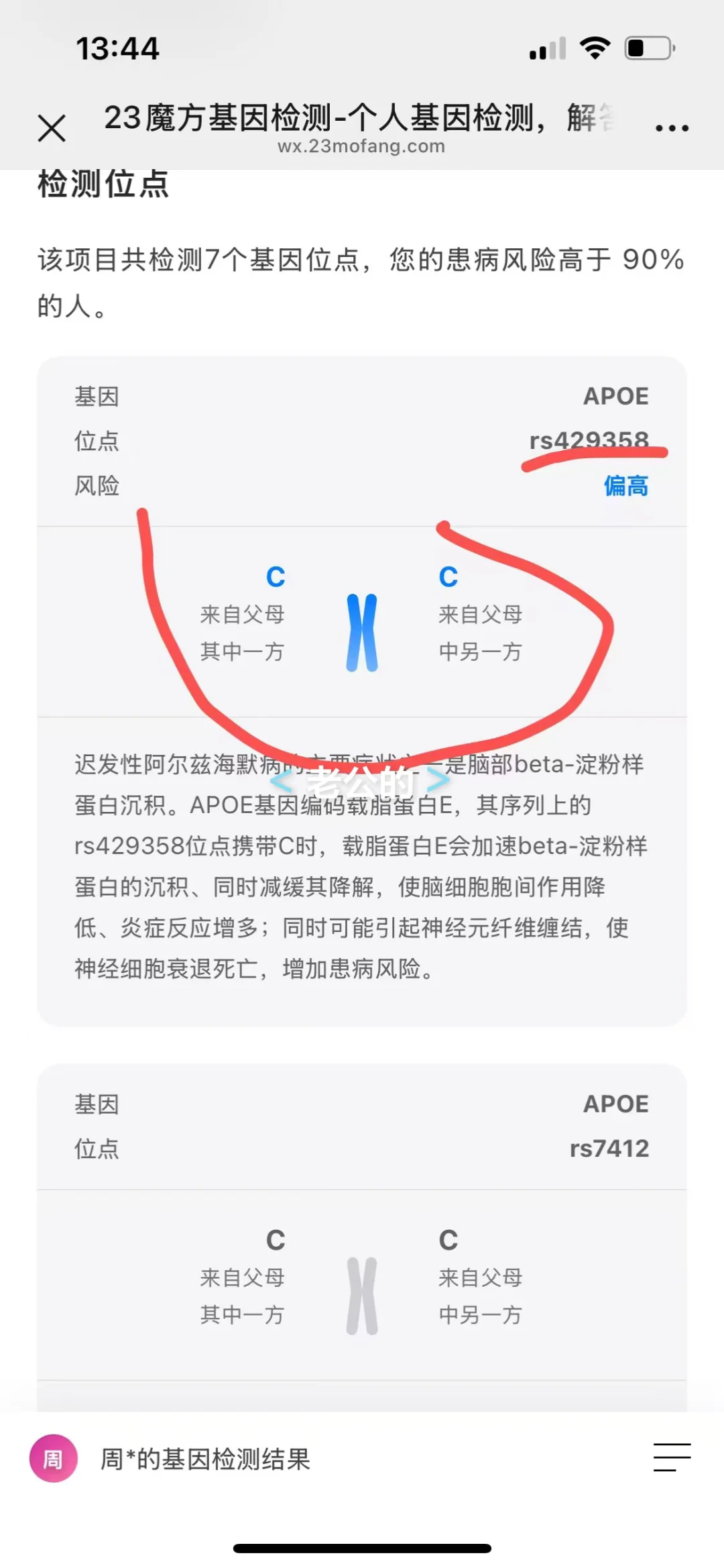 双E4中招