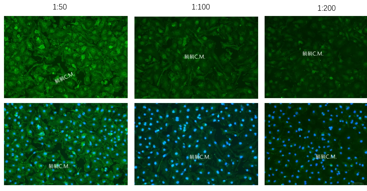 手把手教你做细胞免疫荧光
