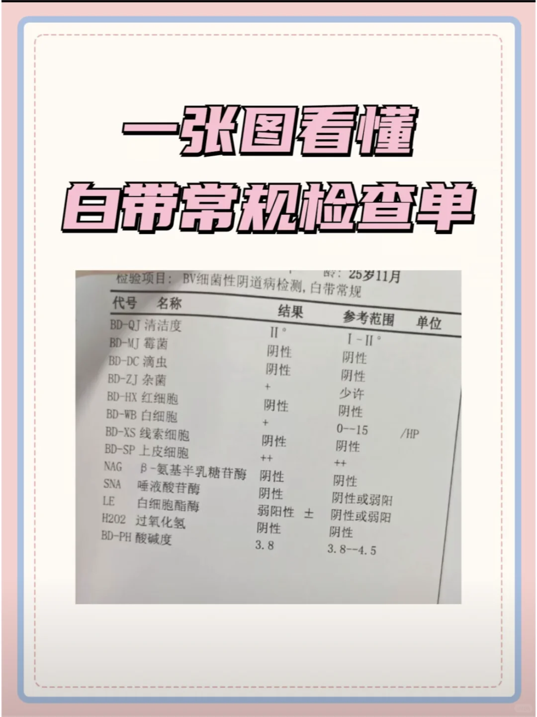 妇科医生教你一张图看懂白带常规检查单