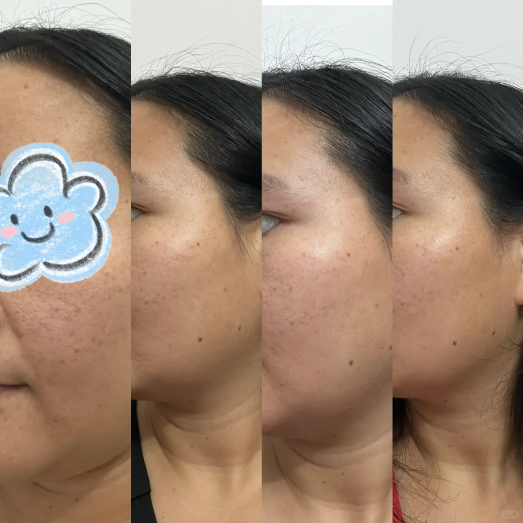 美翔胶原蛋白30天真实打卡分享