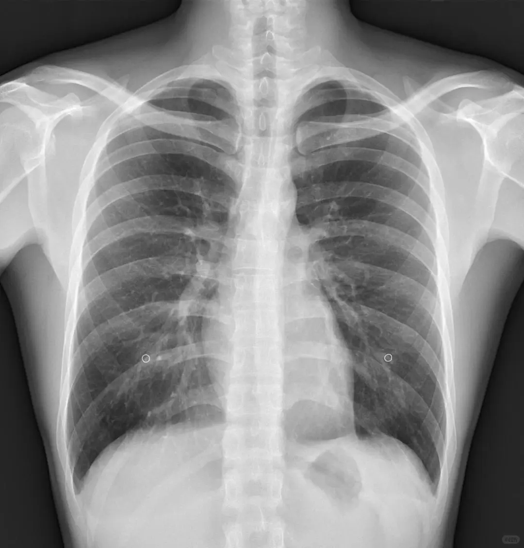 别再被体检套餐“套路”！每年体检该查什么